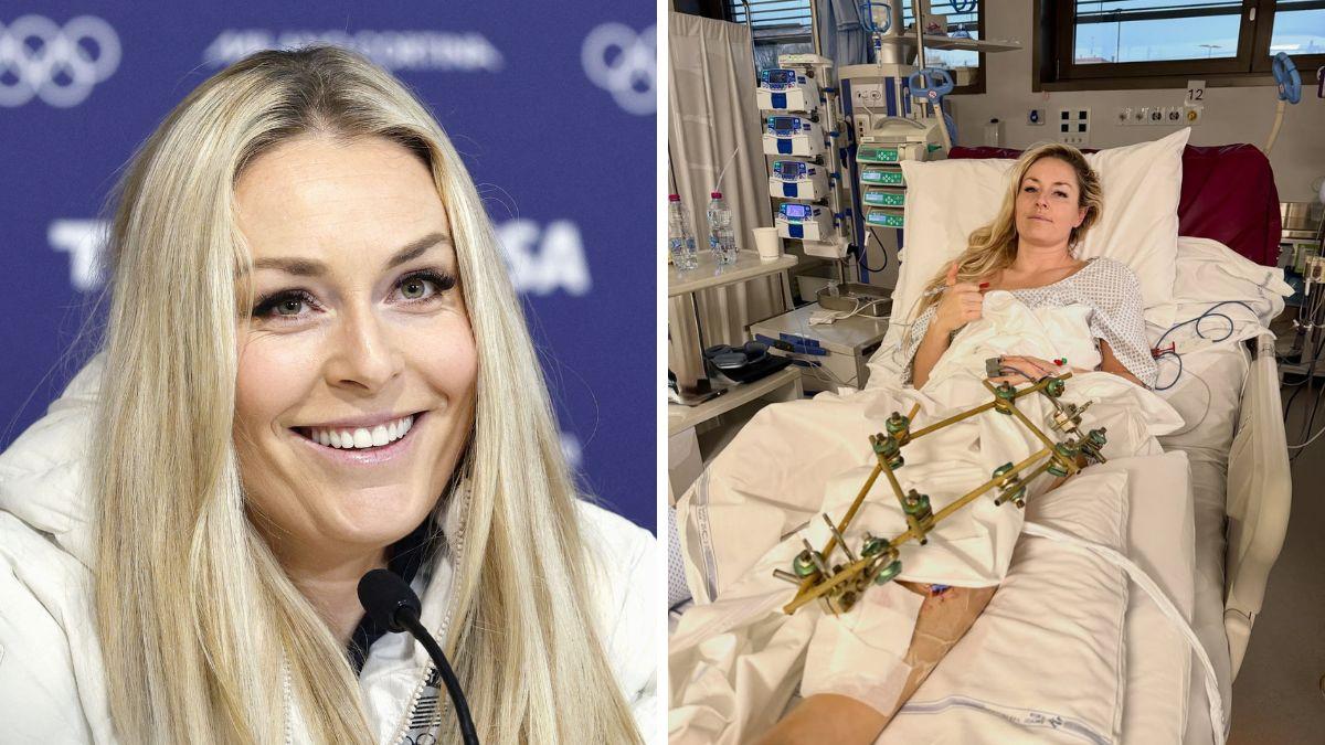 lindsey vonn injuries over the years full timeline