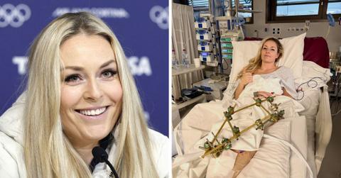 lindsey vonn injuries over the years full timeline