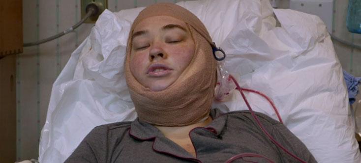 Mama June Skin Removal Surgery