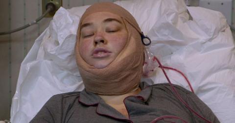 Mama June Skin Removal Surgery