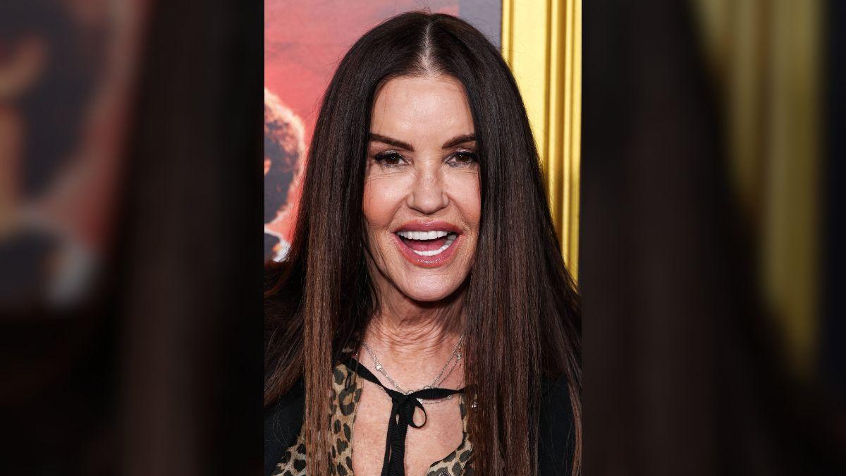 Photo of Janice Dickinson's injuries took three months to heal. 