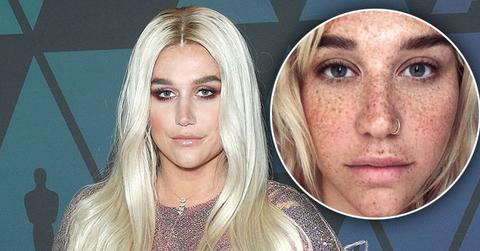 Kesha Freckles Makeup Free PP