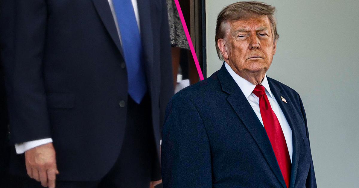 Donald Trump’s Swollen, Discolored Hand At White House Events Fuels Concern Amid Makeup Efforts To Conceal Bruising