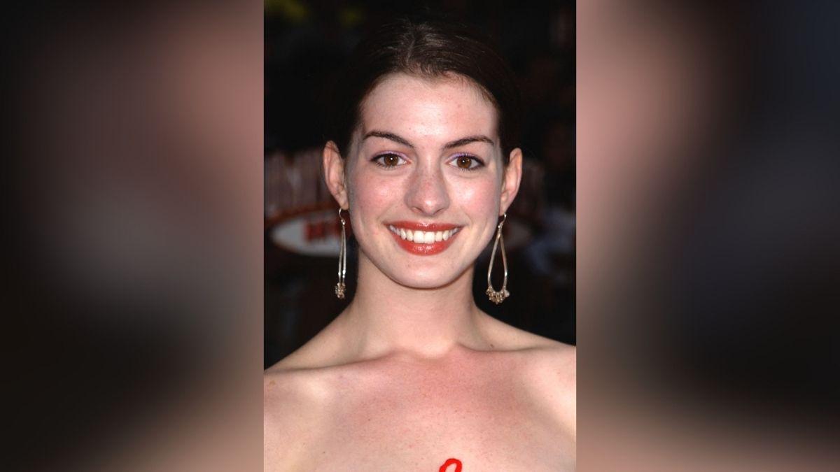 anne hathaway transformation before after photos
