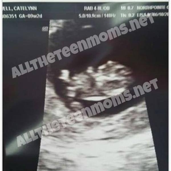 catelynn-lowell-sonogram