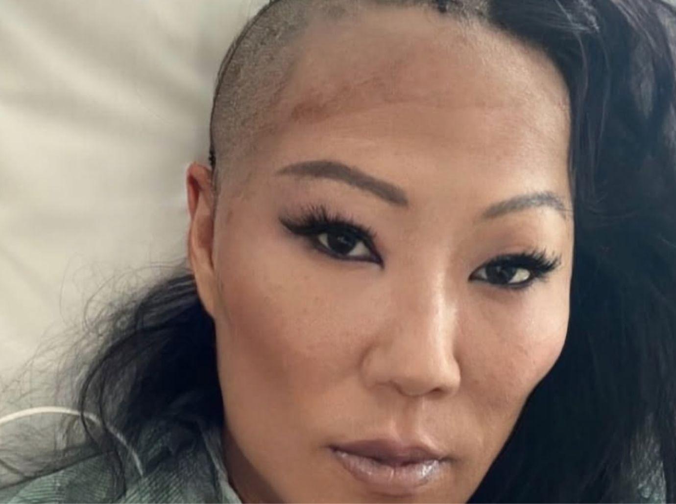 'Bling Empire: New York' Star Lynn Ban Dead After Emergency Surgery