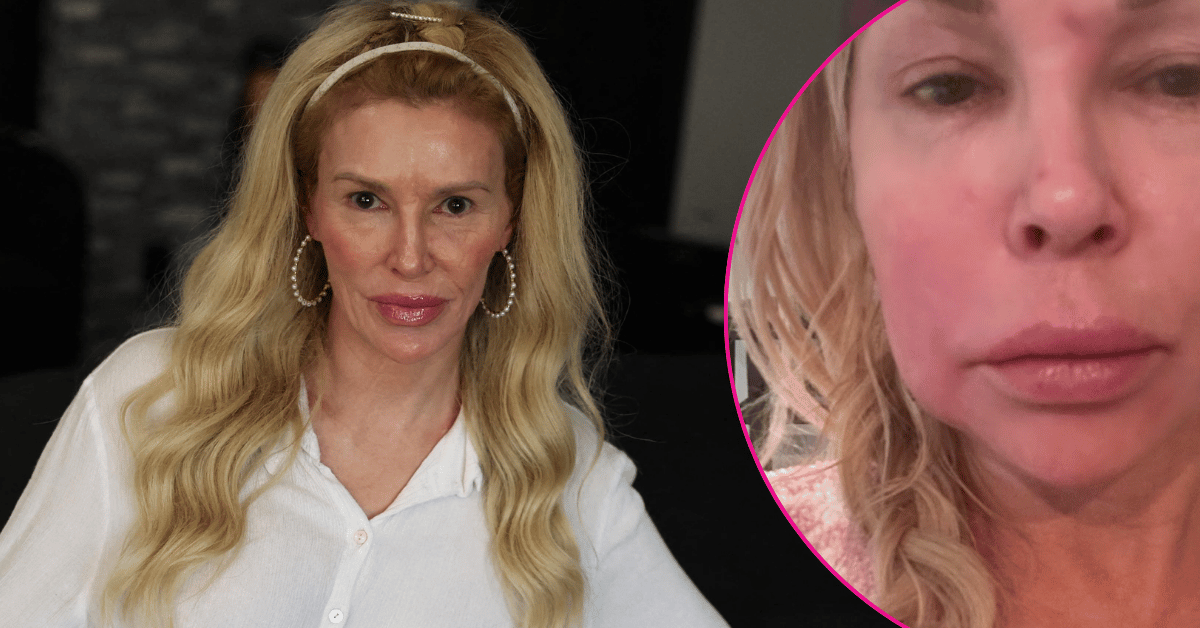 Brandi Glanville Health Nightmare: 'RHOBH' Star Reveals&hellip;