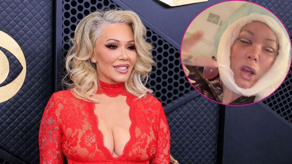 composite photo of bunnie xo