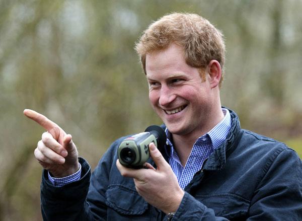 Prince harry hair plugs hair loss issues updates 03