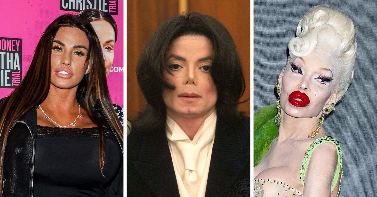 Celebrities Who Had The Craziest Plastic Surgeries