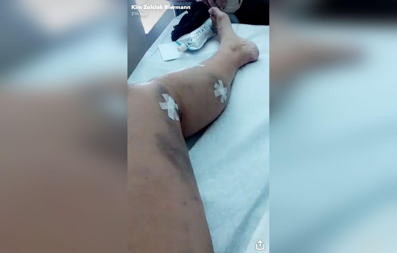 kim zolciak biermann surgery