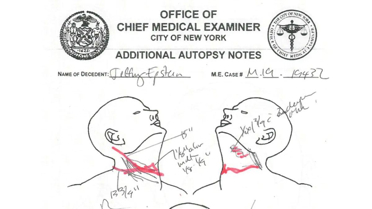 Image of A forensic pathologist hired by Jeffrey Epstein's brother, Mark, is convinced the disgraced financier died by homicide.