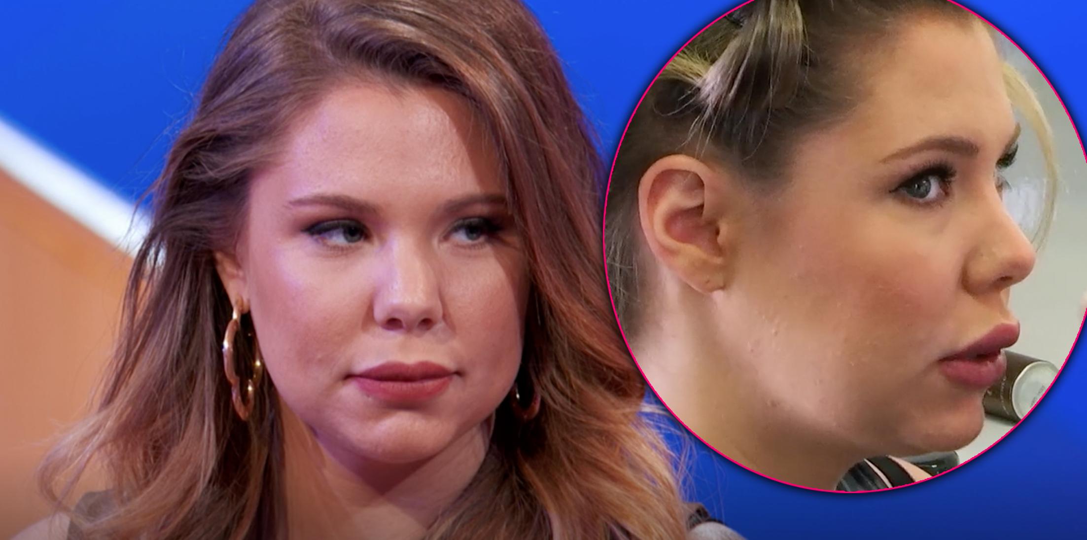 Kailyn lowry plastic surgery photos botox h