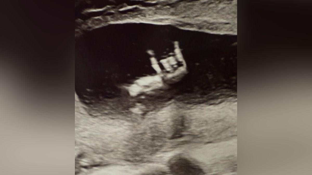 Image of Barbara Palvin and Dylan Sprouse shared a sneak peek into a sonogram.