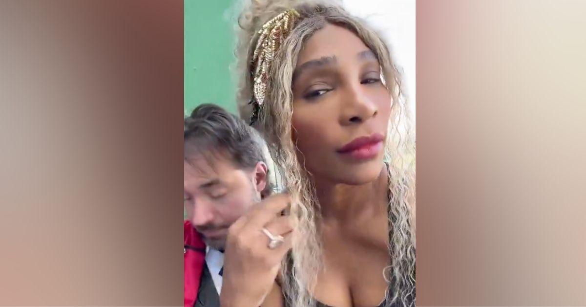 serena williams bleached skin speculations