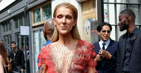 celine dion doesnt have control over muscles stiff personpp