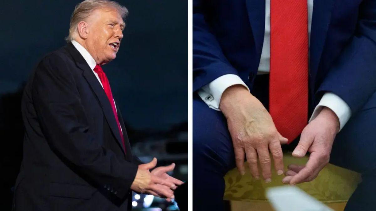 image of Donald Trump’s appearance at public events sparked further debate.