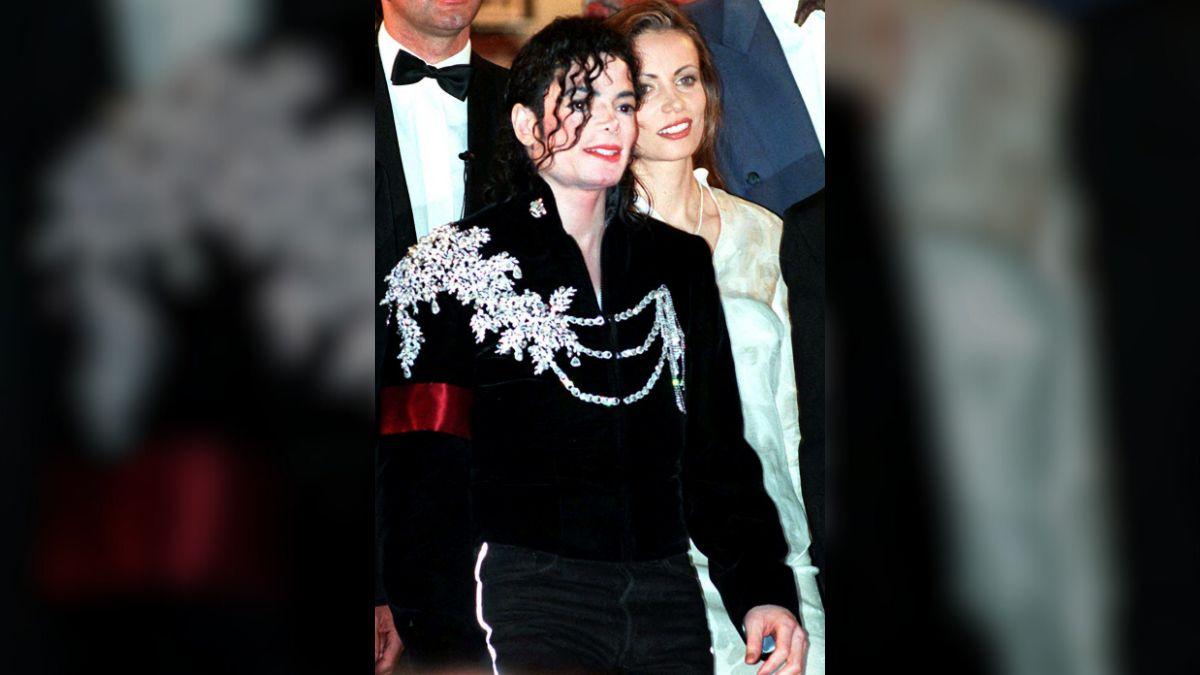 Image of Michael Jackson acknowledged his vitiligo.