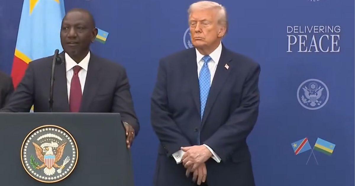 image of The president tried to cover up his hands with makeup and bandages.