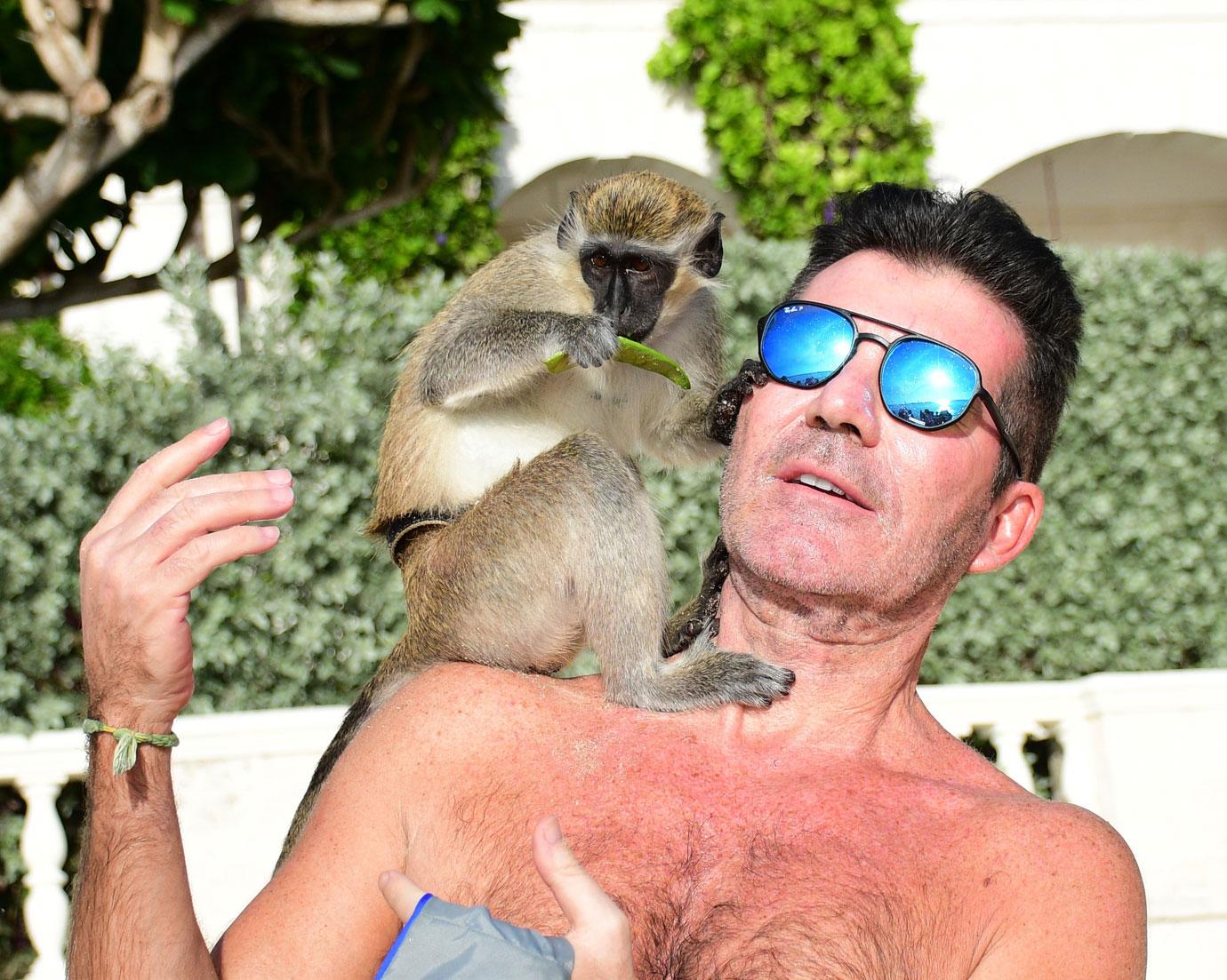 Simon Cowell surgery