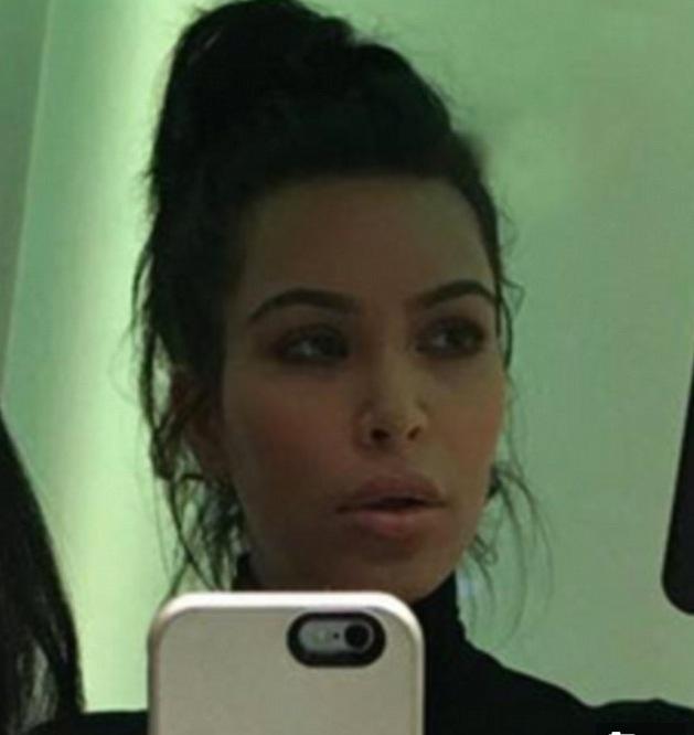 Kim kardashian plastic surgery face puffy post birth saint west 04