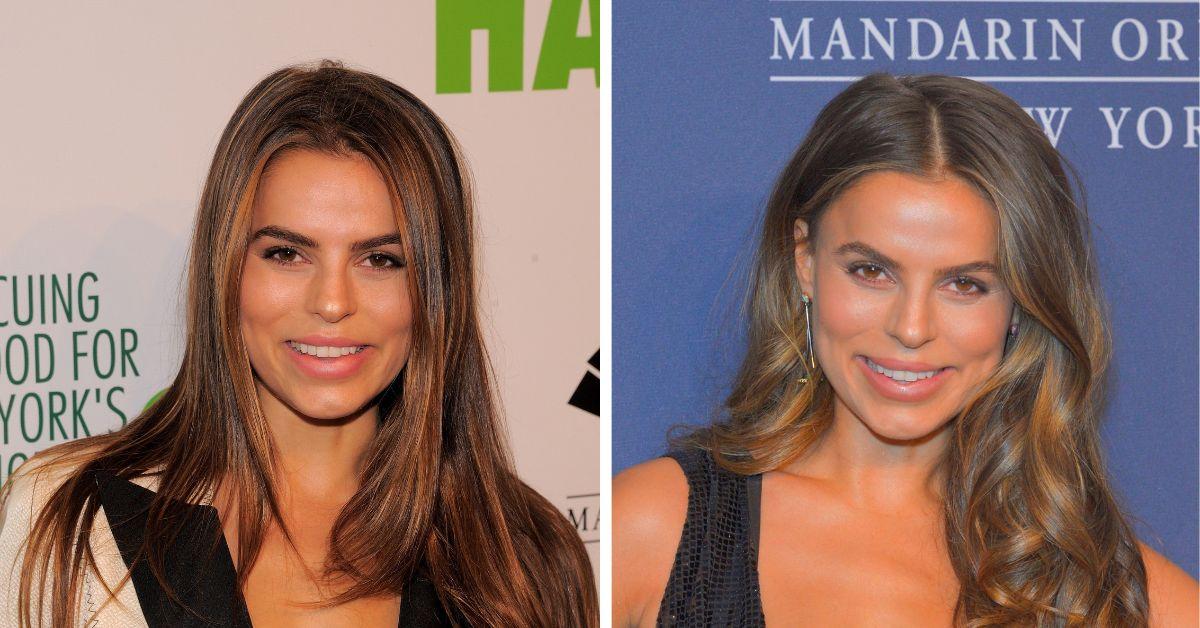 image of Brooks Nader dissolved her facial fillers after criticism.