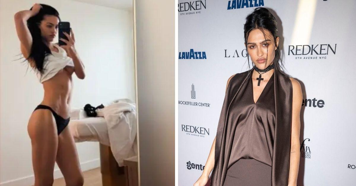 image of The model denied ever getting lip fillers.