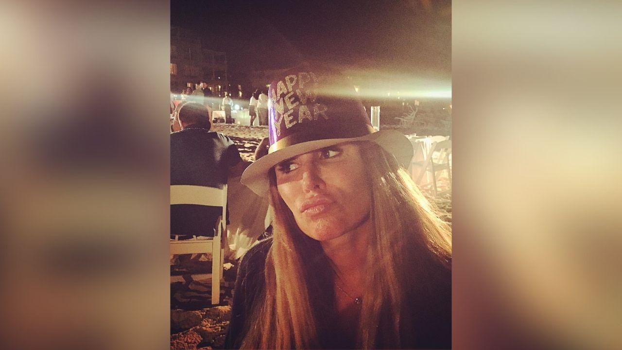 rachel uchitel dramatic facelift transformation before after photos