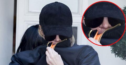 Khloe kardashian lip plastic surgery