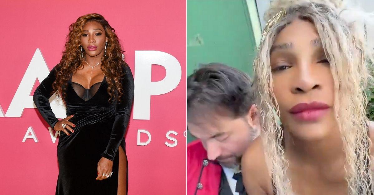 serena williams bleached skin speculations