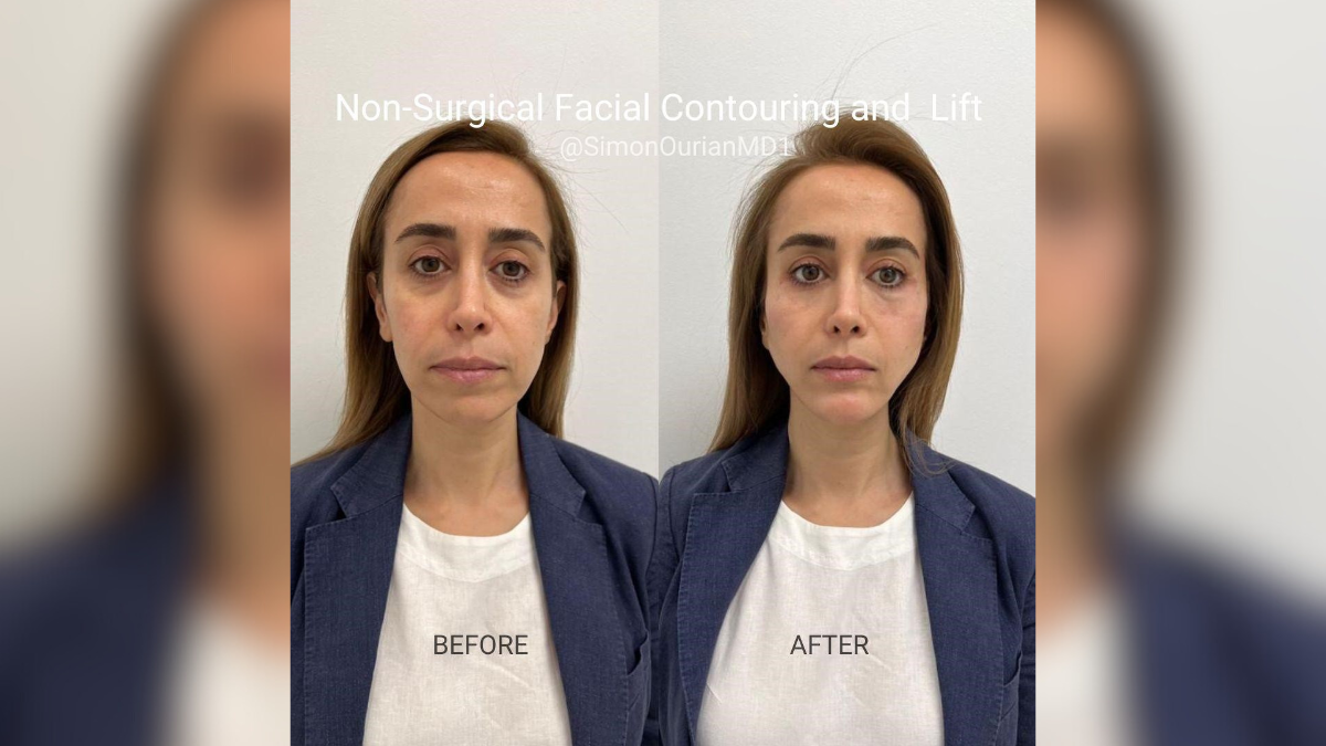 rethinking rejuvenation dr simon ourian on regenerative treatments in modern facial aesthetics