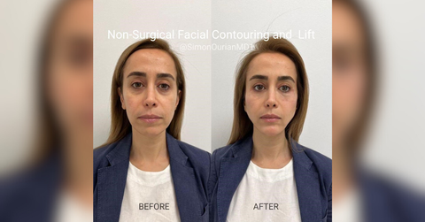 rethinking rejuvenation dr simon ourian on regenerative treatments in modern facial aesthetics