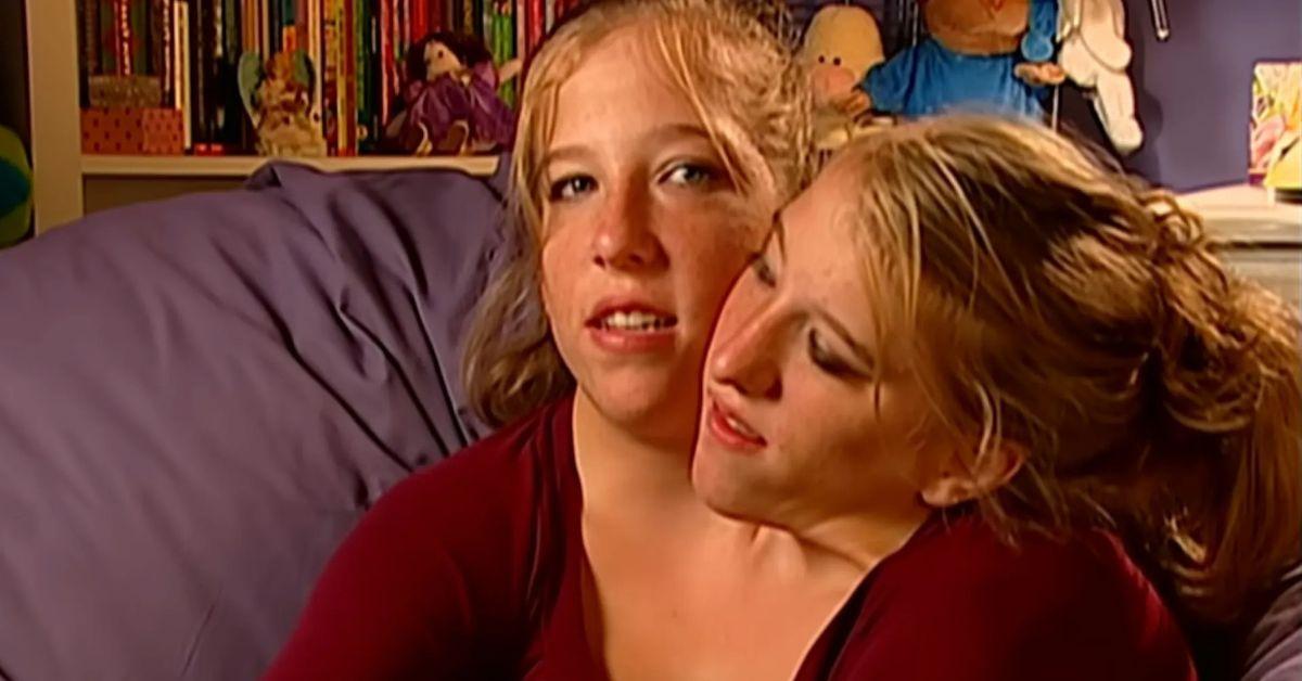 Photo of Abby and Brittney Hensel are fused together at the pelvis.