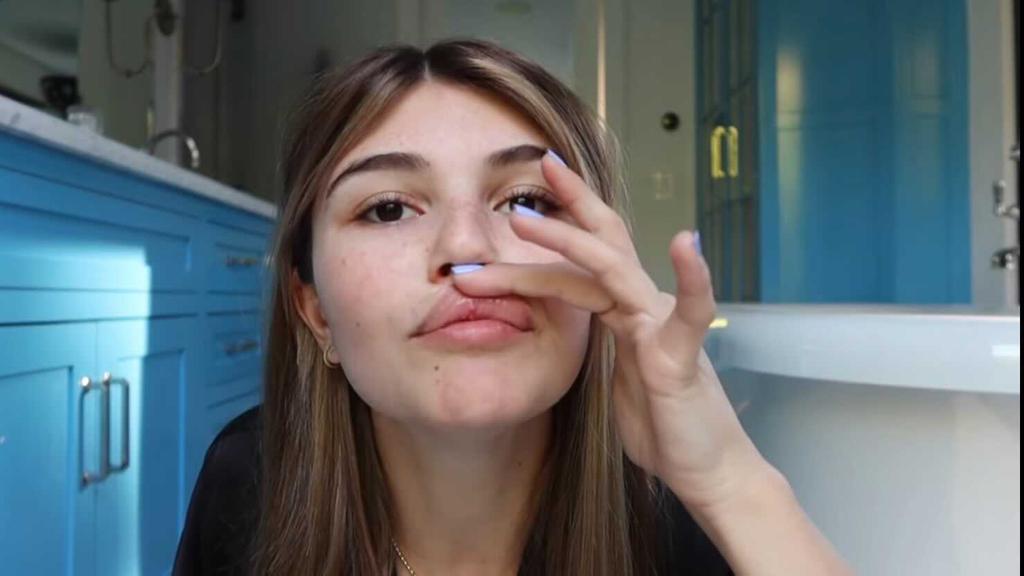 Olivia Jade Injures Lip, Head, Nose After Fainting Incident