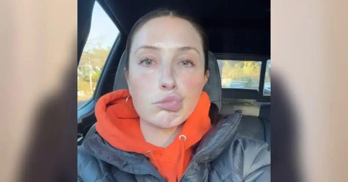 Photo of Bristol Palin revealed her battle with facial paralysis in January.