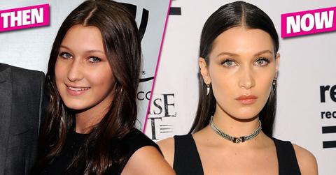 Bella Hadid Plastic Surgery Nose Job HERO