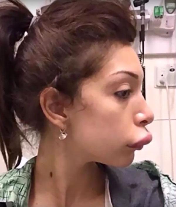 Farrah abraham plastic surgeries 01