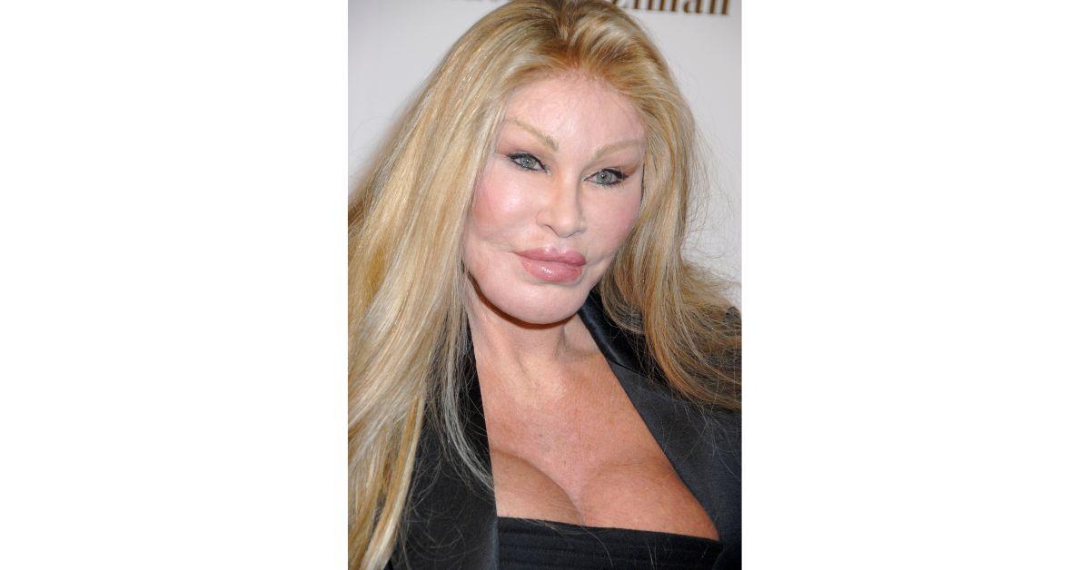 Jocelyn Wildenstein's Transformation Gallery Before & After Photos