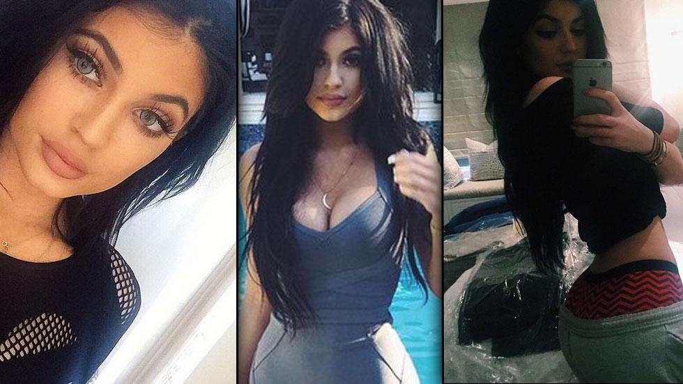 Kylie Jenner's Plastic Surgery Transformation: Before and After