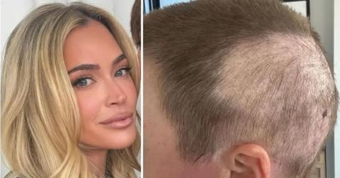 Teddi Mellencamp Is The ‘Ultimate Fighter’ Amid Cancer Battle