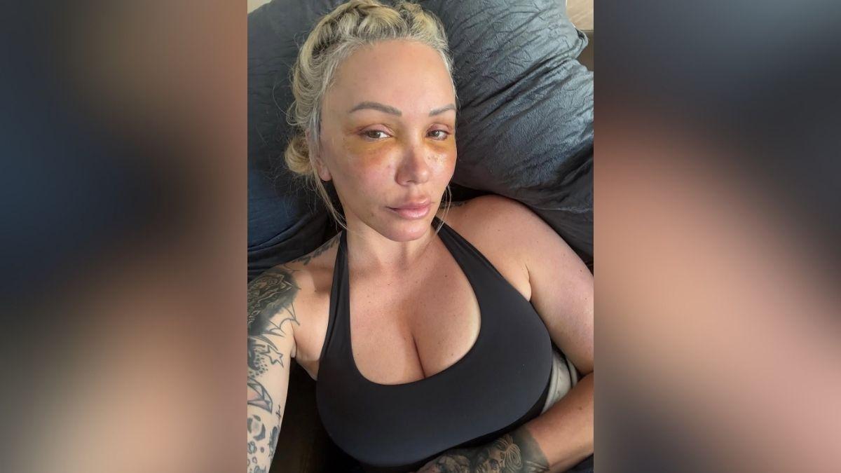 bunnie xo dramatic transformation before after photos