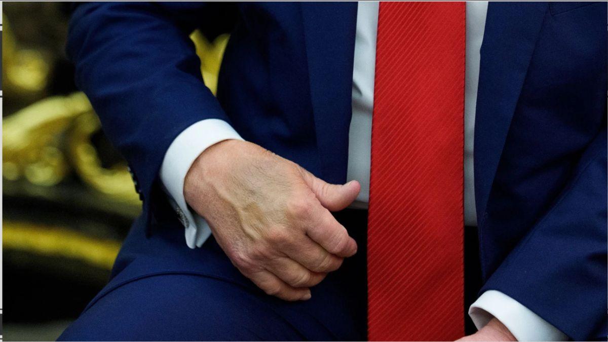 Image of Trump's bruised hand
