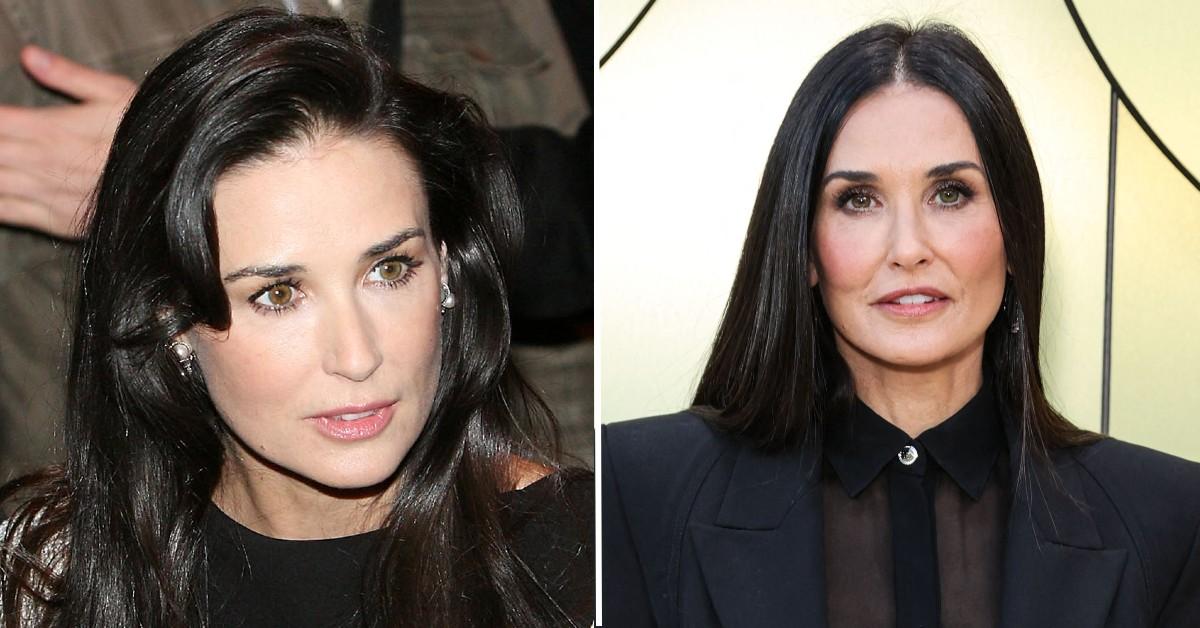 Did Demi Moore Have Plastic Surgery? Doctors Weigh In On Her Look