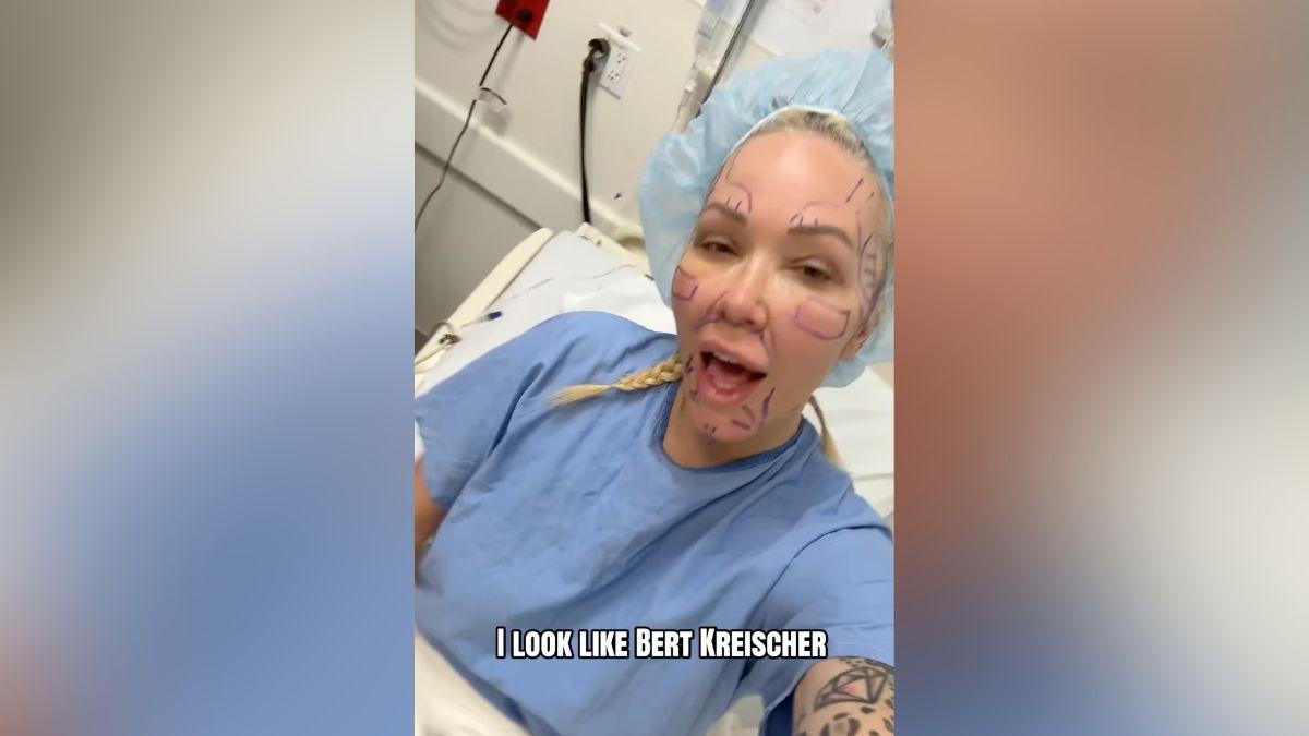 Image of Dr. Daniel J. Gould performed Bunnie Xo's procedure.