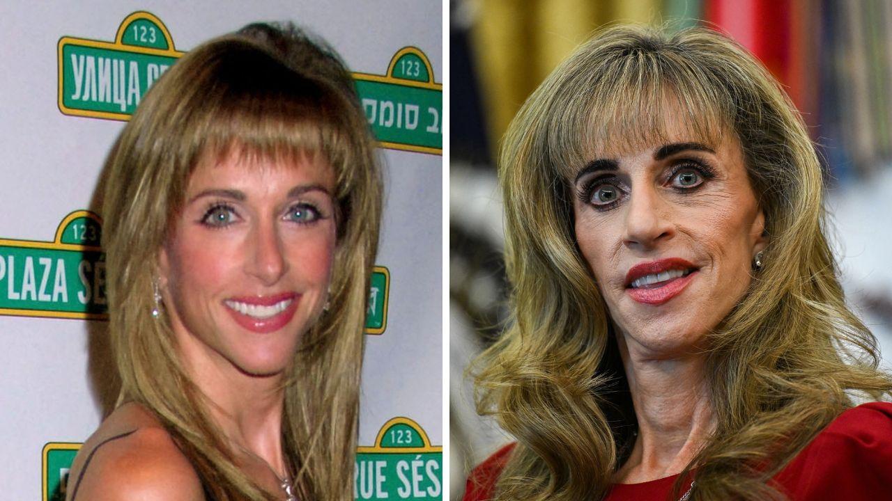did susan dell get plastic surgery mar a lago face explained