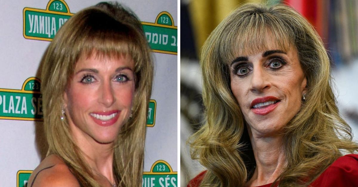 What Happened to Susan Dell's Appearance? 'Mar-a-Lago Face'&hellip;