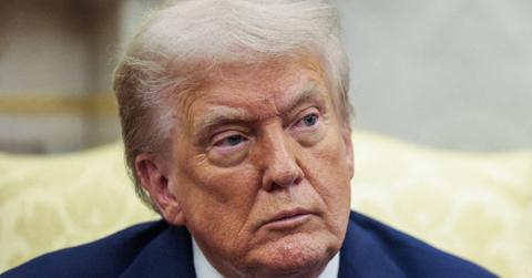 donald trump swollen cankles