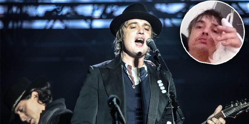 pete doherty hospitalized hedgehog