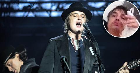pete doherty hospitalized hedgehog
