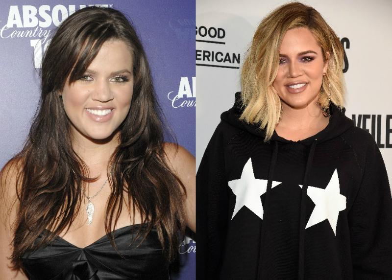 Khloe kardashian celebrity plastic surgery